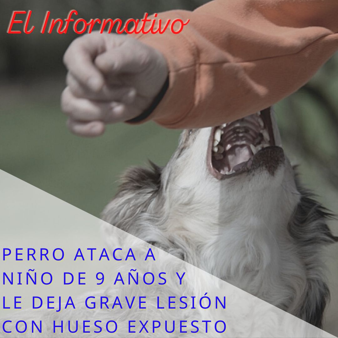 Perro ataca a niño y le desgarra parte del brazo izquierdo en la provincia de Caravelí